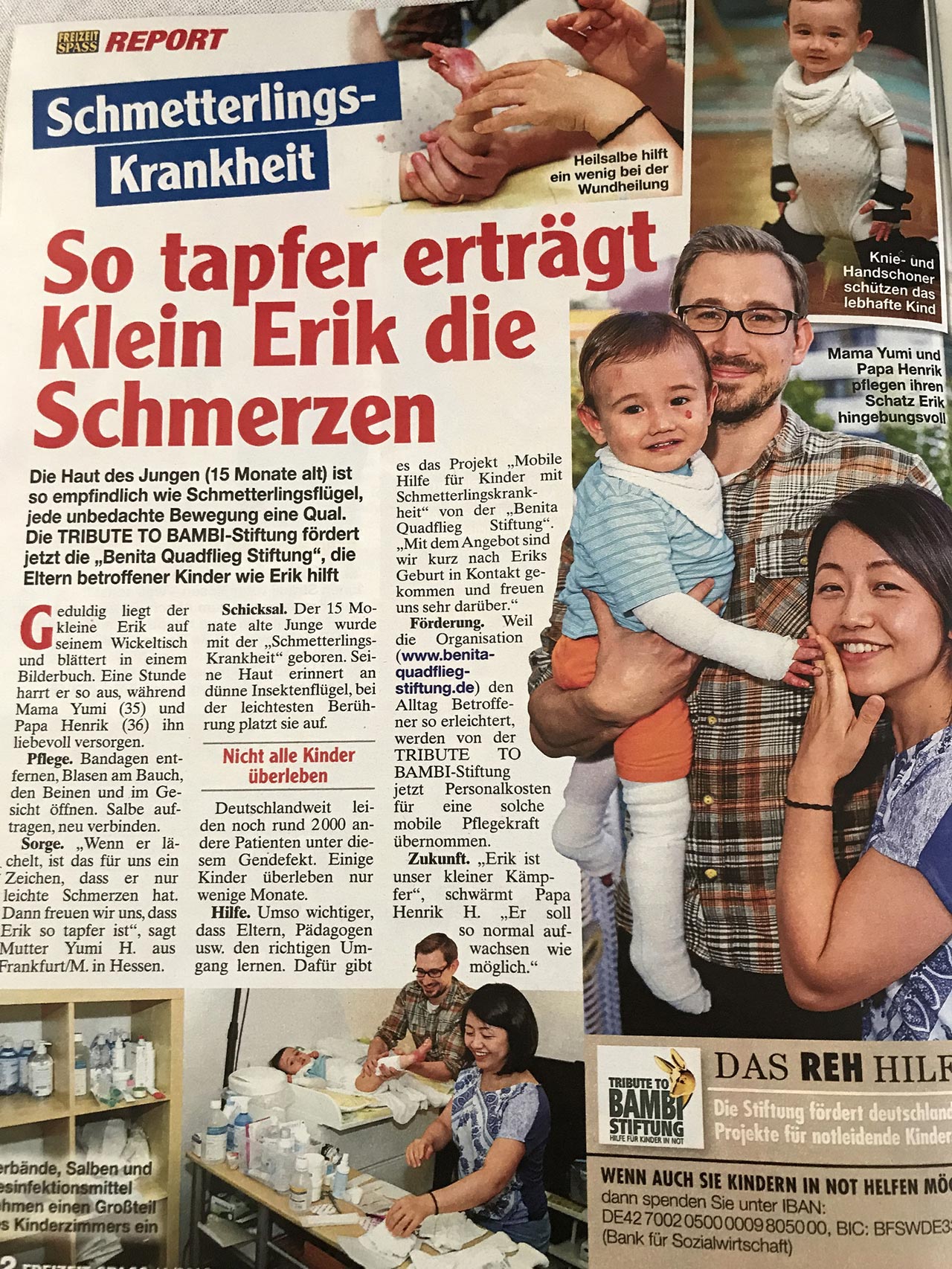Mobile Hilfe für Kinder mit Schmetterlingskrankheit 1